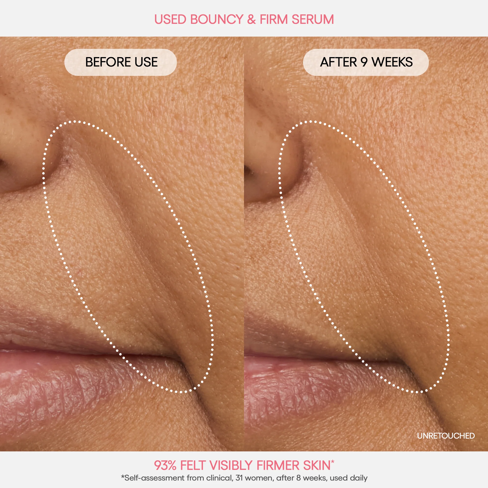 Bouncy Skin On The Go - Image 7