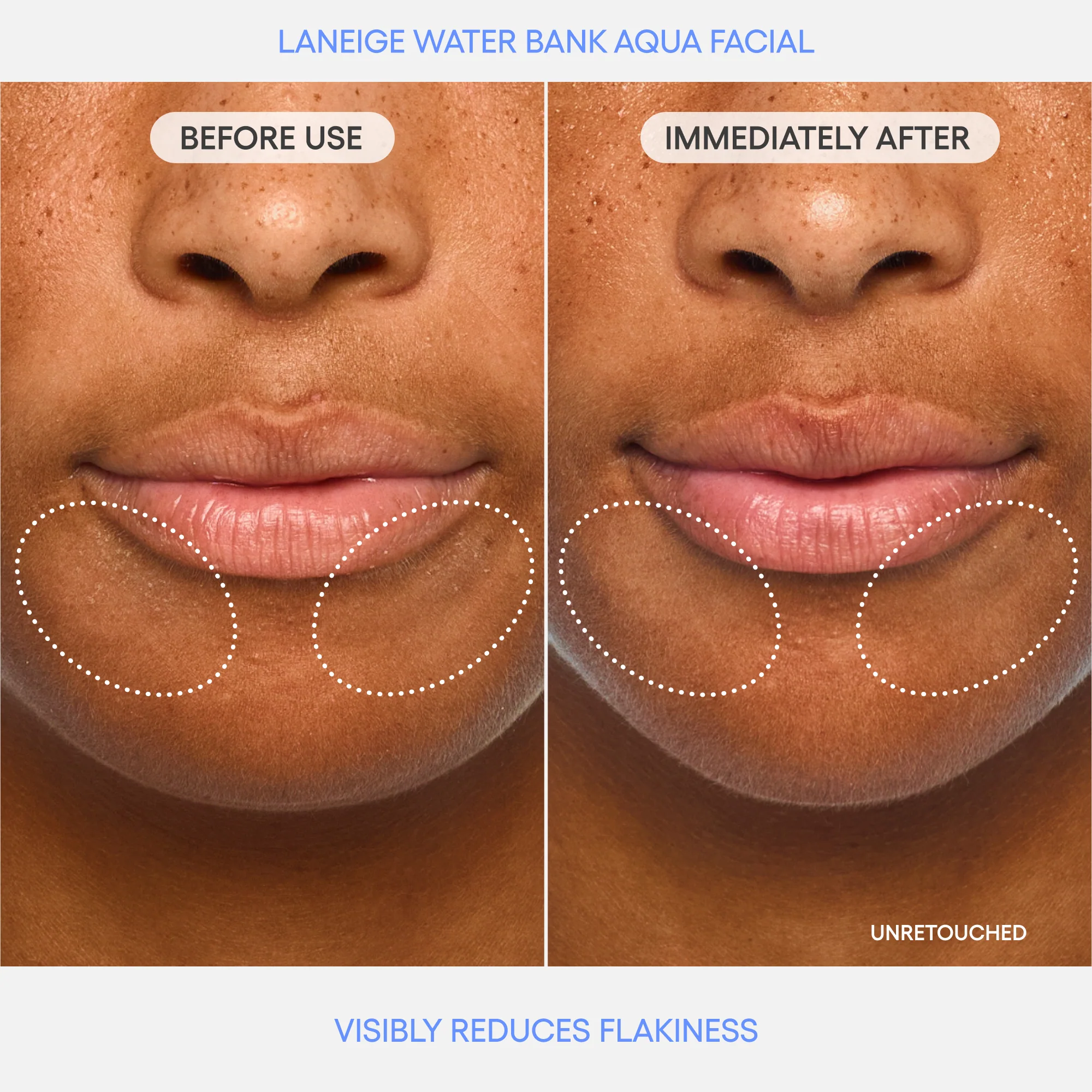 Water Bank Aqua Facial - Image 3